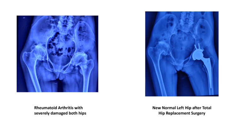 022c9f516b0975c1b05d1d4deec5f256-3