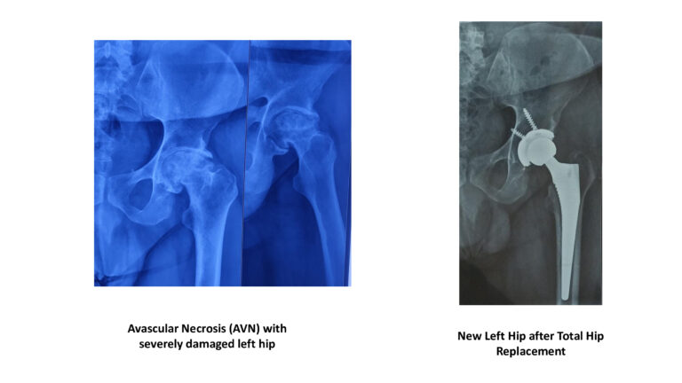 022c9f516b0975c1b05d1d4deec5f256-4