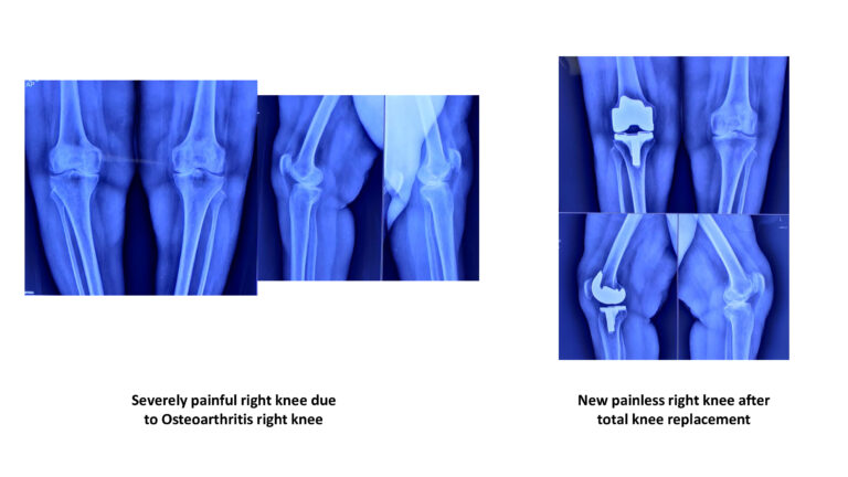 022c9f516b0975c1b05d1d4deec5f256-6