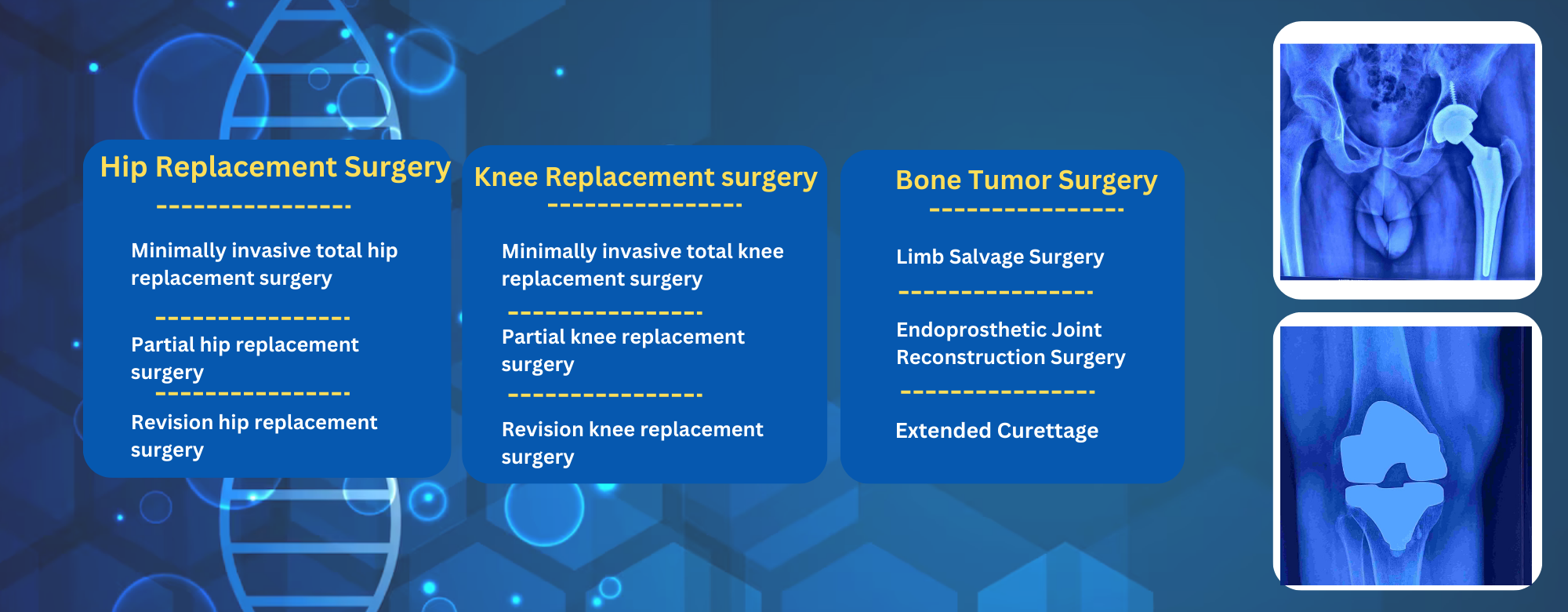 Hip Replacement Surgery (4)