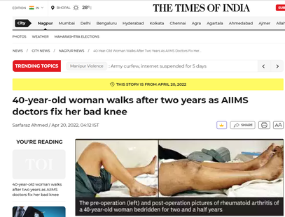 Knee Replacement Surgeon