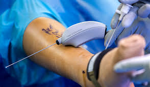 Ankle Surgeon