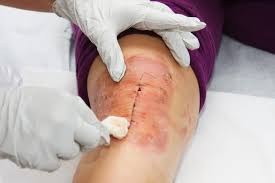 Arthroscopic Surgeon